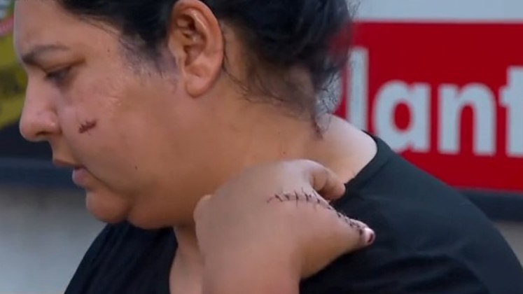 Segundo Kátia, Josafá
obrigou o filho dela, de outro relacionamento, a levá-lo até a casa de
Adilson, o atual namorado. Quando chegou ao local, o acusado invadiu o imóvel e
deu o primeiro golpe em Adilson, que ficou ferido na orelha. Depois, ele partiu
para cima da mulher, que recebeu vários golpes e precisou lutar para não perder
a vida