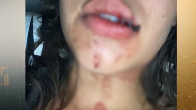 Fotos mostram Geovana com vários ferimentos causados pelos rapazes que a convidaram para o evento. A influenciadora ainda diz que foi dopada e obrigada a manter relações sexuais com pelo menos três rapazes que estavam no sítio