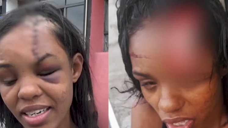 Quando a polícia chegou ao local, Viviane estava no lado de fora, na calçada, com um grave ferimento na cabeça. Ela foi socorrida em um hospital da zona norte de São Paulo