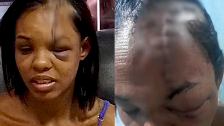 Durante as agressões, ele bateu a cabeça da esposa diversas vezes até Viviane perder a consciência e desmaiar. Quando acordou, percebeu que o companheiro havia dormido e decidiu pedir ajuda da mãe. 