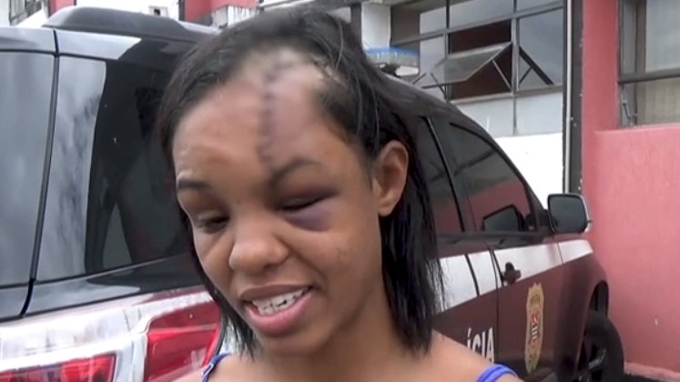 Ele não teria gostado do horário que a jovem chegou e a agrediu covardemente “Ele me pegou pela blusa e me jogou no chão. Quando caí, bati a cabeça na parede. Levantei, ele me pegou pelas costas e batia a minha cabeça na parede. Por várias vezes, ele falava que ia me matar”, disse a vítima.