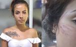 Nicolly nega que teria tido um caso com o proprietário do local e ainda denunciou as condições vividas durante sua passagem na clínica. ''Eu estava sofrendo tudo, menos tratamento'', afirmou.
