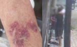 O Cidade Alerta acompanha o caso de dona Isabel, de 86 anos, que foi agredida pelos inquilinos em Franco da Rocha (SP). O casal acumulava reclamações e uma confusão com outro vizinho. Câmeras de segurança flagraram o momento em que eles atacam a proprietária da casa e seu filho Carlos. Depois da agressão, Wilson e a esposa deixaram a casa sem pagar uma dívida de quase R$ 2 mil e a idosa quer vender tudo e se mudar o quanto antes. Entenda