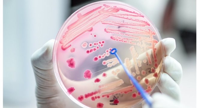 Cientista observa micróbios em laboratório; estudo identifica que relação entre células humanas e micróbios não é equilibrada