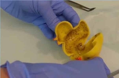 Cientistas descobrem bactéria mortal dentro de patinhos de borracha