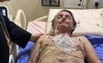 Cirurgia Bolsonaro 