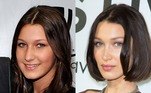 O Dr. Lee examinou fotos da modelo Bella Hadid, de 24 anos.“Acho que ela fez cirurgia de nariz, de pálpebra, lipoaspiração de pescoço, remoção de gordura bucal [bichectomia] e preenchimento de testa”, contou