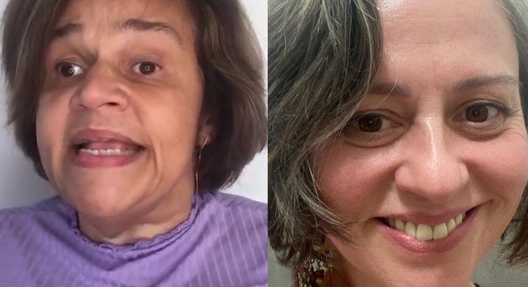 Claudia Rodrigues e Guta Stresser: as duas têm esclerose múltipla