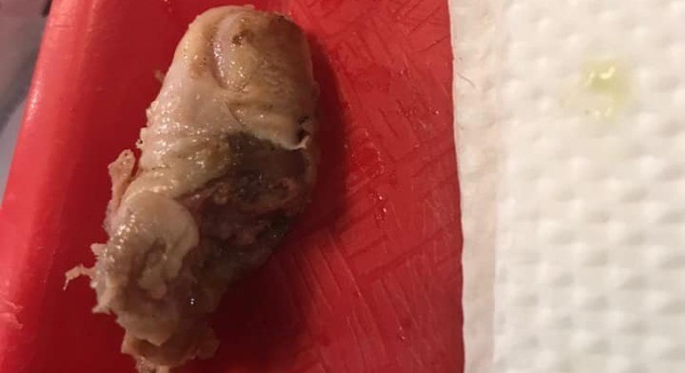 Suposto dedo encontrado em hambúrguer vendido por lanchonete na Bolívia