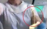 Conforme mostrado nas imagens, a equipe médica usou um tubo para remover a longa e esguia criaturaVale o clique: Homem é achado vivo em cemitério 4 meses após ser declarado morto