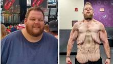 Homem perde 163 kg em dois anos, sem fazer cirurgia, e luta contra o excesso de pele