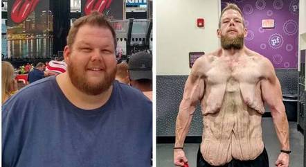  Cole Prochaska antes e depois de emagrecer
