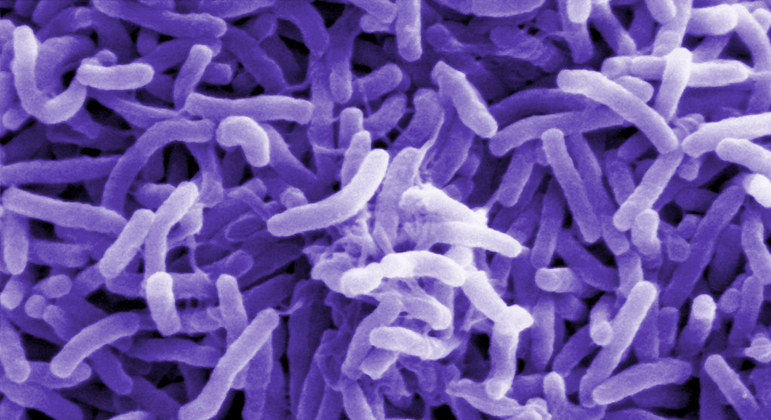 Cólera é causada pela bactéria 'Vibrio cholerae'
 