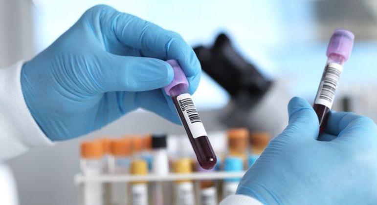 Um simples exame de sangue já é suficiente para estimar o LDL, o colesterol ruim, e levantar a suspeita de HF