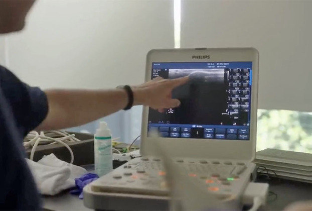 Com o ultrassom, ele vê como estão o coração, pulmão, ligamentos. 
