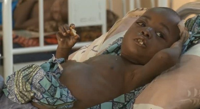 Mbandaka, com 1,5 milhão de habitantes, confirmou o primeiro caso da doença