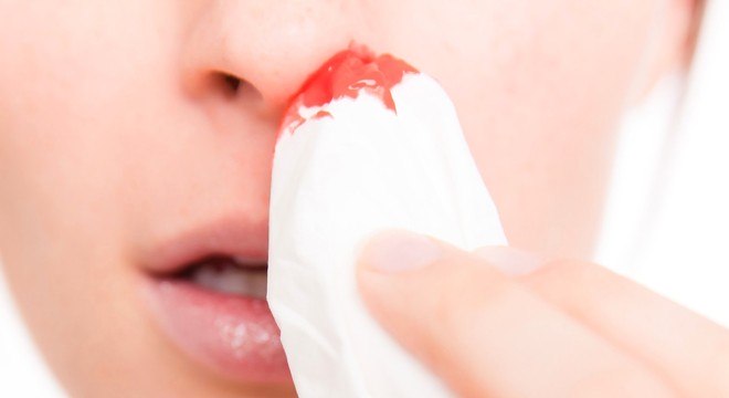 Conheça quais são os sintomas da dengue saiba como tratar