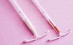 contraceptivo-diu-hormonal