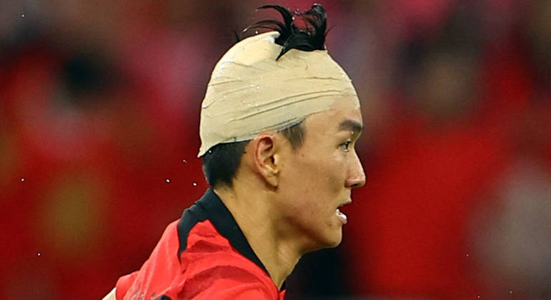Hwang In-beom usa uma proteção na cabeça após se machucar em lance contra Gana