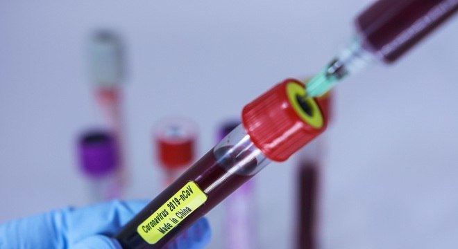Casos de pacientes em investigação de coronavírus faz alerta a estados