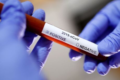 Rio de Janeiro confirma terceiro caso de coronavirus