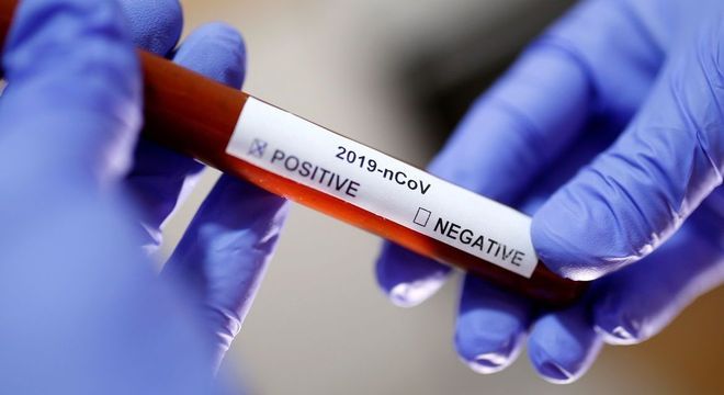 Estados Unidos registram primeira morte por coronavírus