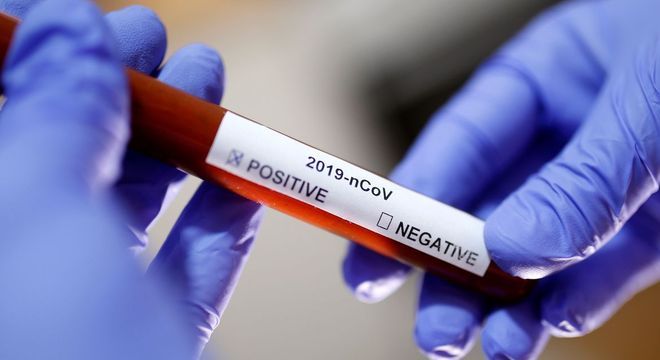 Teste usado para detectar novo coronavírus. Brasil já tem dois casos confirmados