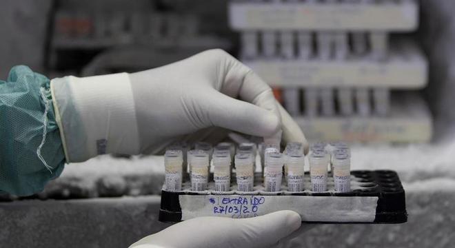 Iniciativa deve acelerar compra de itens necessários para realização de testes 