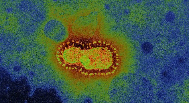 Segundo critérios do Ministério da Saúde, reinfecção deve ser detectada com testes RT-PCR com intervalo de no mínimo 90 dias