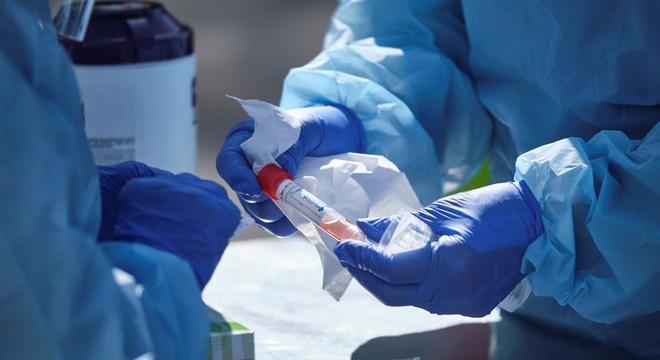 Governo quer distribuir até 5 milhões de kits de testes rápidos para coronavírus
