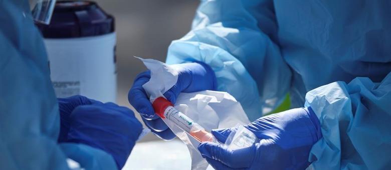 O teste foi fabricado pela companhia Abbott