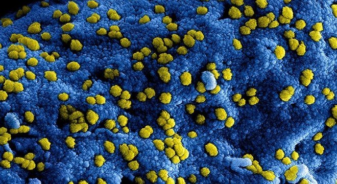 Para se replicar, coronavírus precisa 'sequestrar' célula