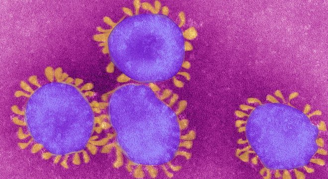 É assim que o coronavírus é visto no microscópio