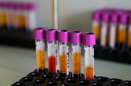 Teste detecta anticorpos 