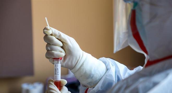 Terapia em teste usa sangue de curados para tratar doentes graves da covid-19