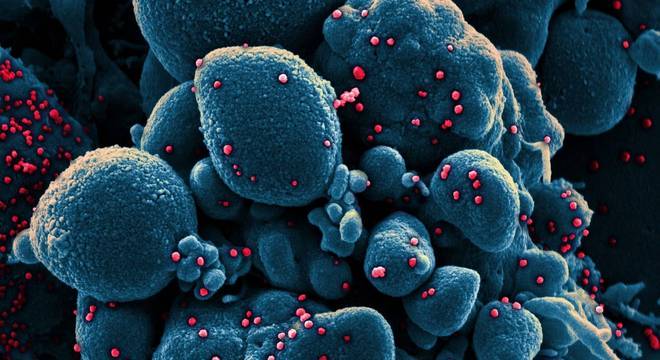 Cientistas propõem combater covid -19 com terapia usada contra câncer