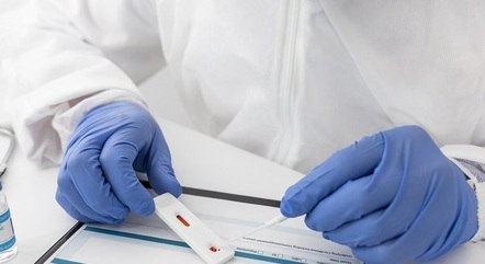 Índices da pandemia em BH registraram queda