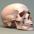 Mulher descobre câncer raro no nariz e é salva por crânio impresso em 3D (Freepik)