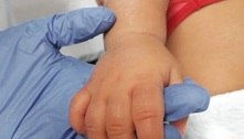 Covid: 'Avassalador', diz médica que viu 3 crianças não vacinadas morrerem