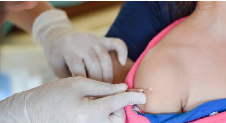 Uma mão com luva aplica uma vacina no braço de uma criança