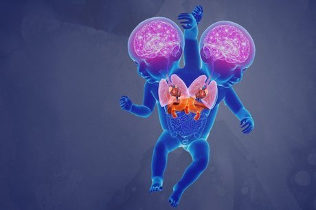  As crianças têm cérebros, pulmões e corações próprios