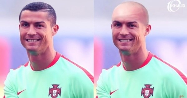 Sem cabelo! Montagens mostram como ficariam os jogadores carecas