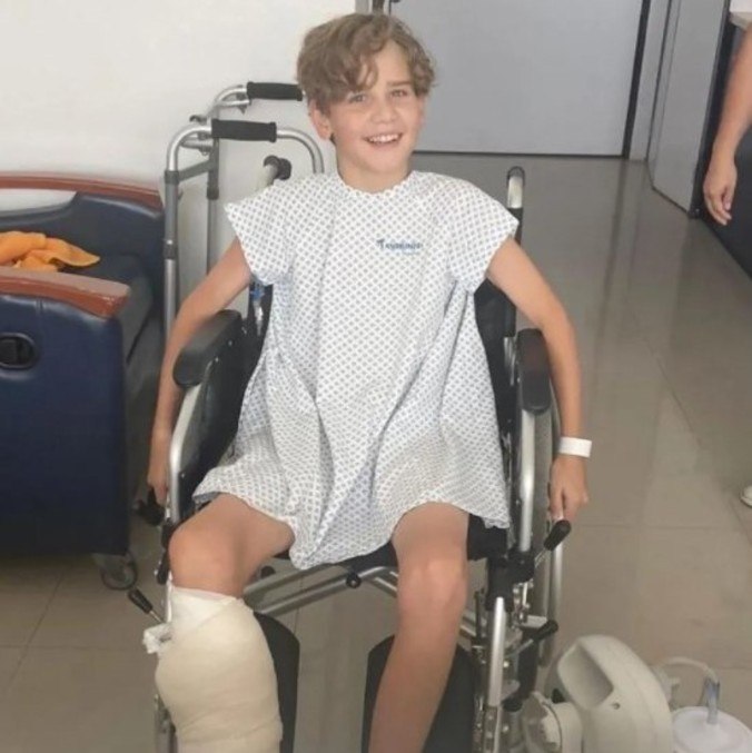 Segundo médicos, Charlie chegou perto de perder a perna