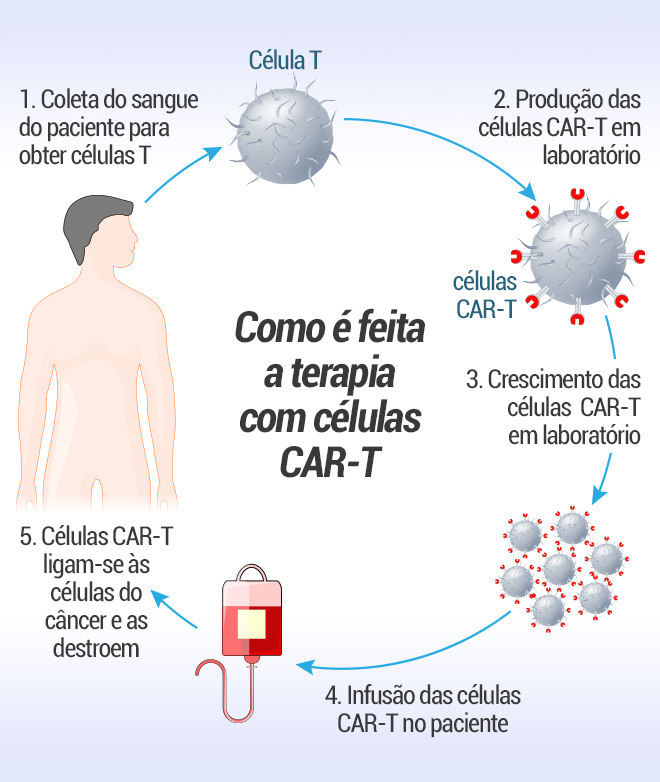 Terapia que eliminou câncer de homem em 30 dias reprograma as células de defesa do corpo; entenda - Notícias - R7 Saúde