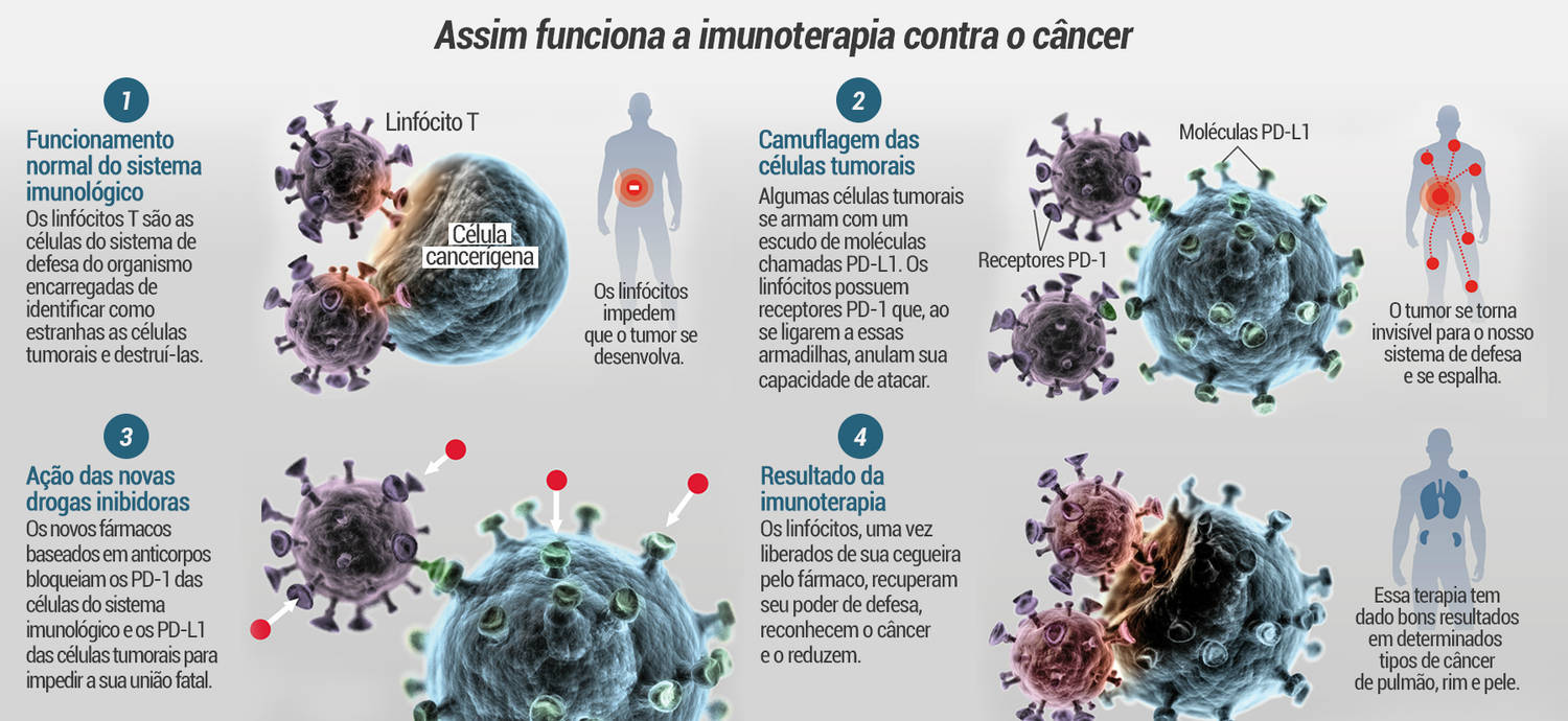 Ce forme de cancer se pot trata prin imunoterapie și care sunt condițiile