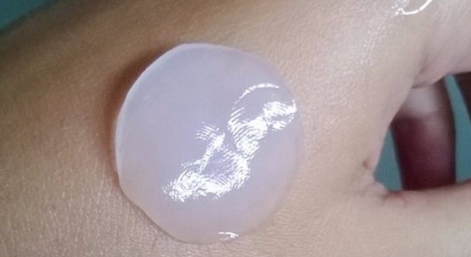 Proteína do abacaxi remove as células mortas de feridas, 'limpando-as e acelerando sua cicatrização', diz pesquisadora
