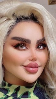 6. Barbie iraquiana fica irreconhecível após 43 cirurgias plásticas