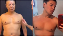David Brazil mostra resultado de plástica para retirar gordura da axila e ficar com peitoral malhado
