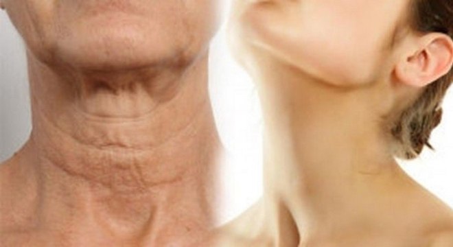 deixar-o-pescoco-mais-jovem-sem-rugas