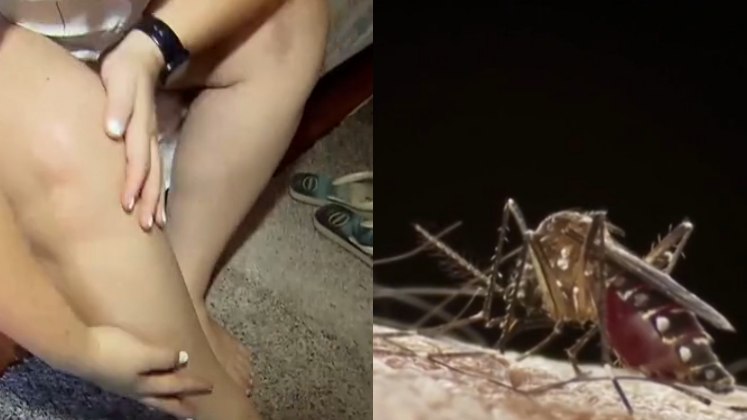 Quanto à teoria da atração do mosquito por líquidos na pele como sudorese e perfumes, o infectologista revela: 